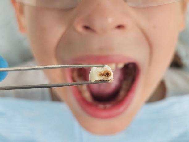 Best Dentist for Tooth Abscess  in Rutherford, TN